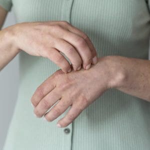 skin-allergy-person-s-arms skin-allergy-person-s-arms